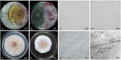 Biological control of Fusarium crown rot of wheat with Chaetomium globosum 12XP1-2-3 and its effects on rhizosphere microorganisms